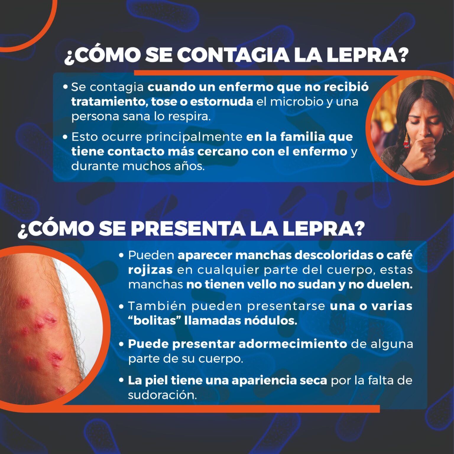 Hoy se conmemora el Día Mundial de Lucha contra la Lepra | Testigo Ocular